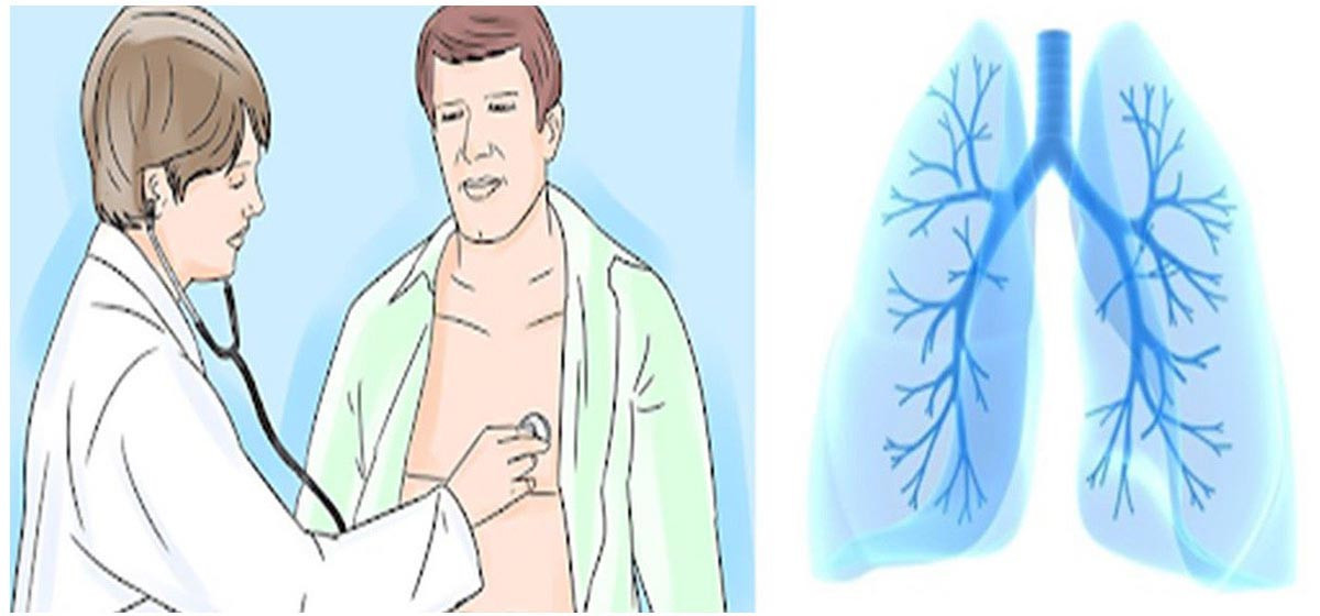 लेटाङमा एक्स–रे मेसिनमार्फत निःशुल्क क्षयरोग परीक्षण अभियान सञ्चालन हुदै।